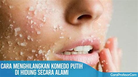 Cara Menghilangkan Komedo Putih Di Hidung Secara Alami Youtube