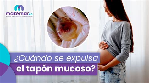 El Tap N Mucoso Es Se Al De Parto Preguntas Frecuentes Maternar