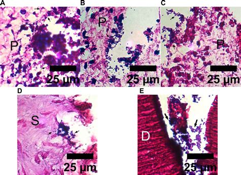 Enterococcus Faecalis Gram Stain