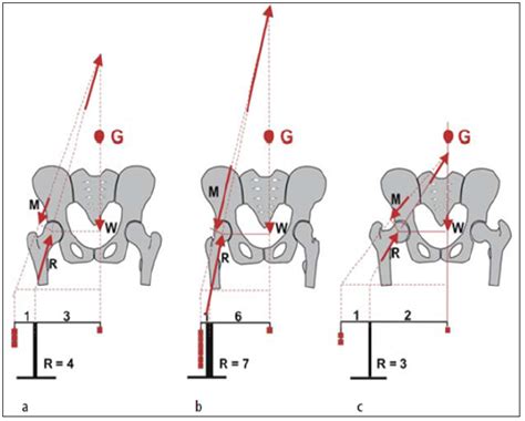 Hip Biomechanics