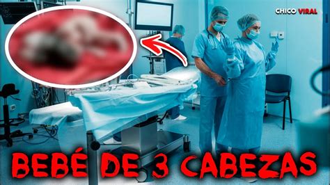 Está es la HISTORIA del BEBE que NACIÓ con TRES CABEZAS YouTube