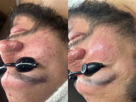 Marissa Carrillo• Acne Specialist Thejuvinexroom • Instagram Photos