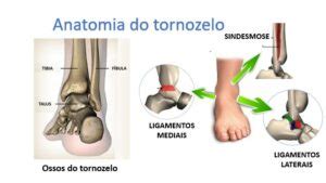 Entorse Do Tornozelo O Que Causa Diagn Stico