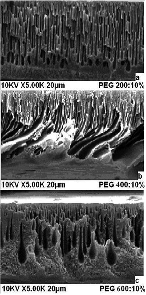 Sem Images Of The Cross Section Of Pet Pvp Membranes With Of A