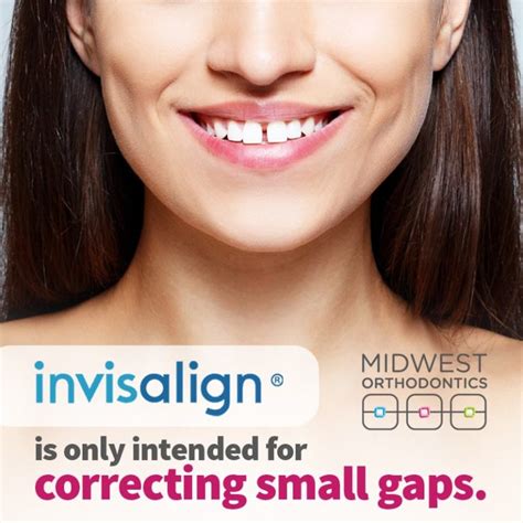 Invisalign Pros And Cons An Alternative To Braces Midwest