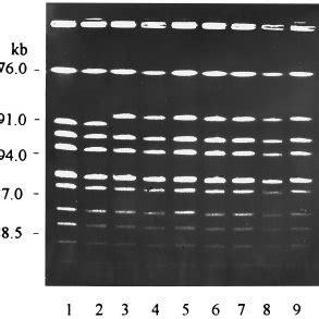 Pulsed Field Electrophoretic Restriction Patterns Of Chromosomal DNAs