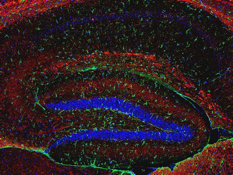 Neuronal Astrocytic Network Of The Mouse Hippocampus