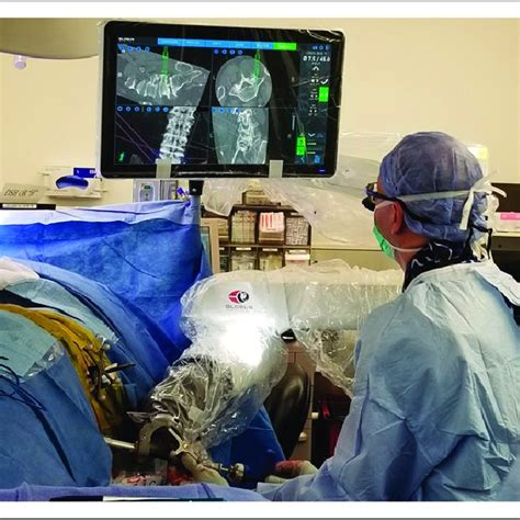 Intraoperative Fluoroscopy Images Show Posterior Hardware And Interbody