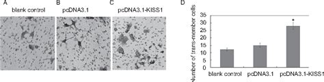 Figure 1 From Mir 21 Downregulated Tcf21 To Inhibit Kiss1 In Renal