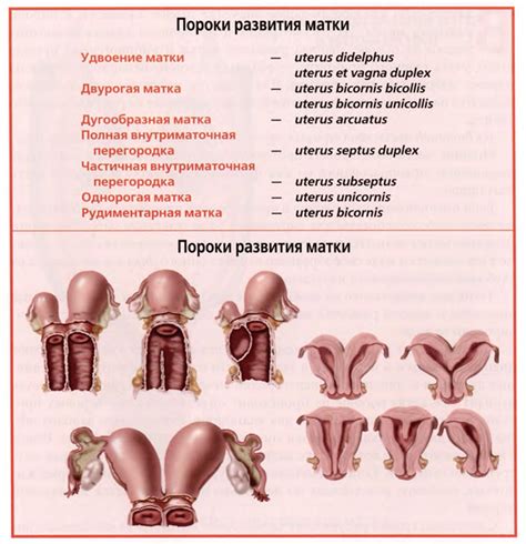 Anteflexio матка что значит после 60 лет