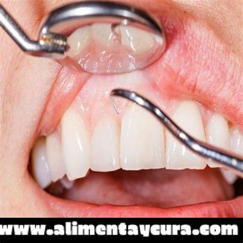 14 razones por las que te sangran las encías al cepillarte los dientes