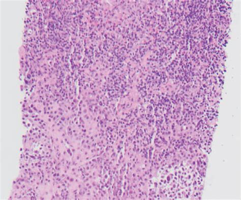 Hematoxylin And Eosin Hande And Immunohistochemical Ihc Staining A