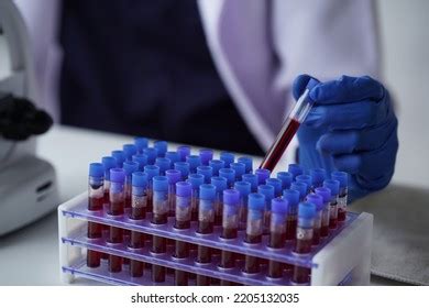 Lab Worker Preparing Test Blood Detection Stock Photo 2205132035