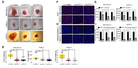 GSTP1 Knockdown Impedes The Growth And Proliferation Of PDAC Cells In