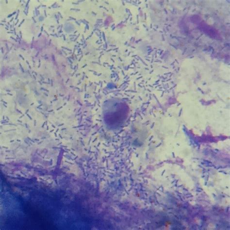 Fecal Wbc Prep With Stain