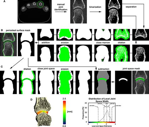 Frontiers High Resolution Peripheral Quantitative Computed Tomography