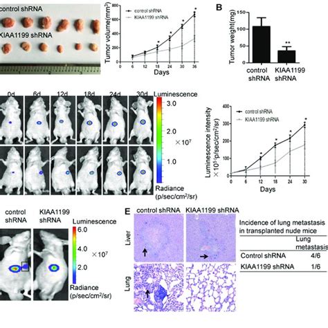 Kiaa Knockdown Suppresses The Growth And Metastasis Of Hcc In Vivo