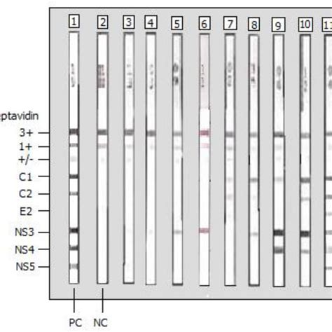 Recombinant Immunoblot Analysis The Inno Lia Hcv Score Assay From