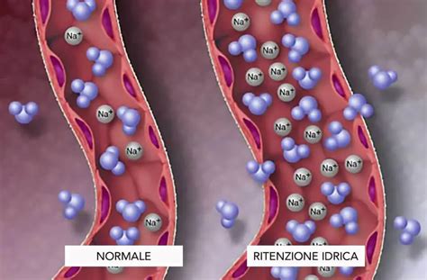 Ritenzione Idrica Sintomi Cause E Trattamenti Biomedic Center