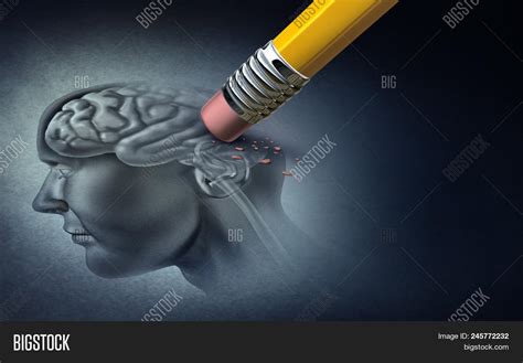 Concept Memory Loss Image & Photo (Free Trial) | Bigstock