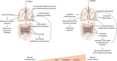 Intestinal Dysbiosis Affects Systemic Immune Responses A Model For The Download Scientific