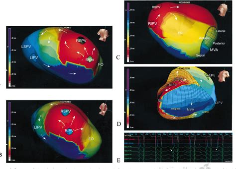 Figure From Characterization Of Left Atrial Activation In The Intact