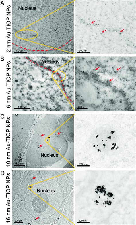 Bio TEM Images Of The Localization Of 2 6 10 And 16 Nm Au TIOP NPs