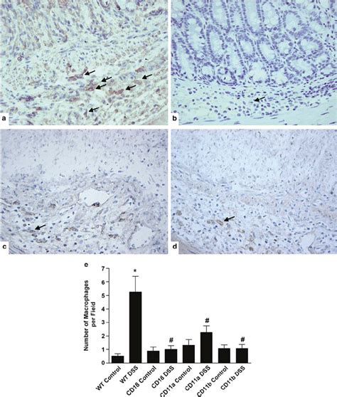 Dss Mediated Macrophage Infiltrationtissue Macrophages Were Identified