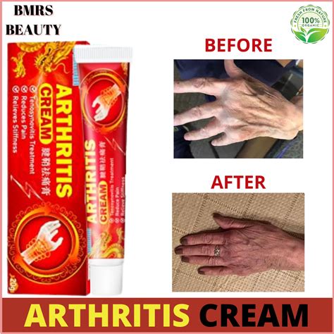 AUTHENTIC AND BEST Arthritis Ointment Joint Pain Relief Cream Easy to Apply Tenosynovitis ...