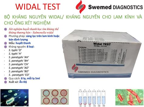 Widal Antigen Test Kit Swemed Vina Ng C Th Nh