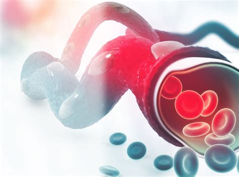 Inr Anticoagulation Management Advanced Heart And Vein Center