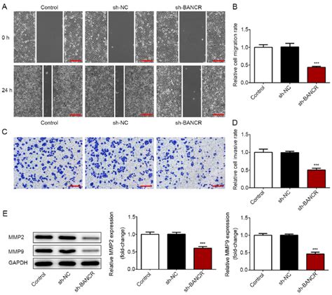 LncRNA BANCR Silencing Inhibits The Migration And Invasion Of