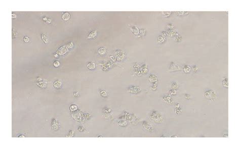 Cne Cell Morphology After Agc225 Treatment A Control Group Scale