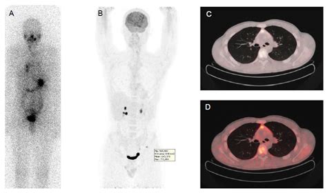 Cancers Free Full Text Advances In Functional Imaging Of