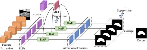 The Schematic Illustration Of Our Prostate Segmentation Network With