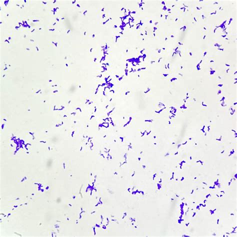 Pathology Outlines Cutibacterium Acnes