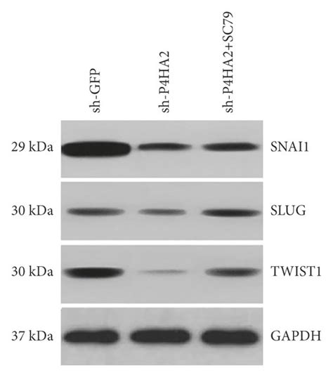 Akt Activation Partially Reversed The Antioncogenic Effect Of P Ha