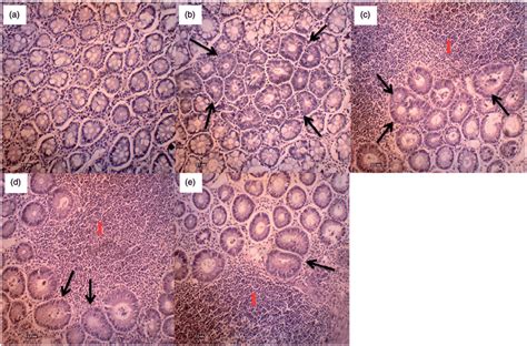 A Normal Histoarchitecture Of Rat Colon B Aom Control Group C