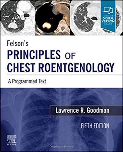 Felson’s Principles Of Chest Roentgenology 5th Edition Pdf Geturebook