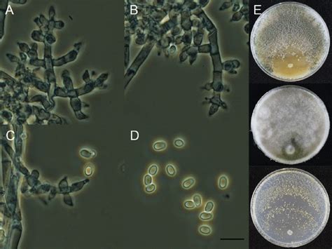 Macroscopic And Microscopic Features Of Trichoderma Spirale Kuc