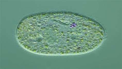 ¿qué Es Un Paramecio Descúbrelo Todo Sobre El Género Paramecium Aquí