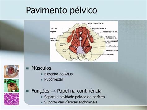 Ppt Patologia Perianal Powerpoint Presentation Free Download Id 829116