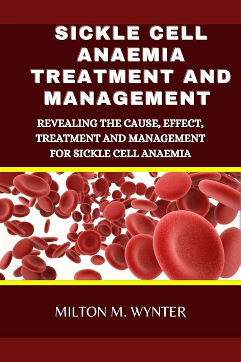 Sickle Cell Anaemia Treatment And Management Revealing The Cause