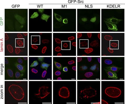 Tyrosine Phosphorylation Of Lamin A By Src Promotes Disassembly Of