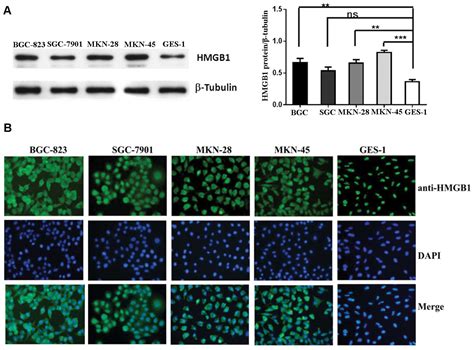 Autophagy Mediated HMGB1 Release Promotes Gastric Cancer Cell Survival