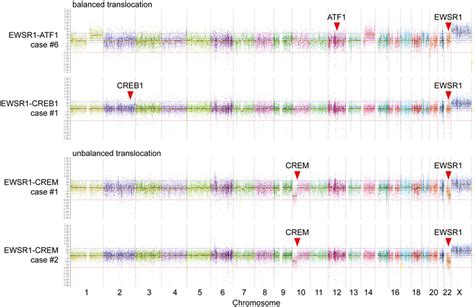 Chromosomal Copy Number Analysis Demonstrates That EWSR1ATF1 And