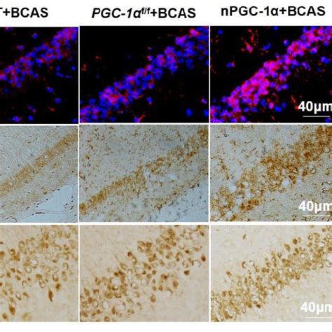 Pgc Induces Hippocampal Bdnf Expression After Chronic Cerebral