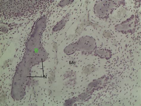 Intramembranous ossification 10x | Histology