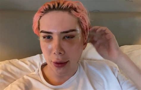 Social Media Star Oli London Gets Plastic Surgery To Become Korean To