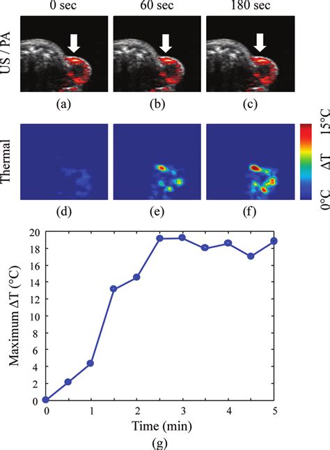 A C Combined Ultrasound And Photoacoustic Images And D F